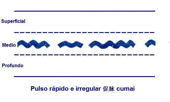 Significado de pulso rápido e irregular | SaludBio
